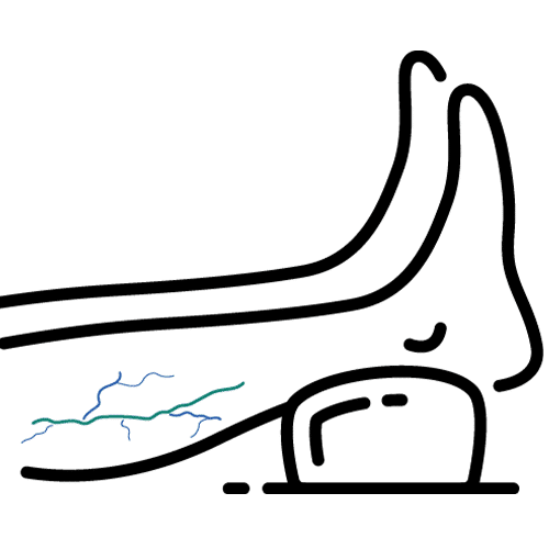 Reticular Veins Treatment Oakland