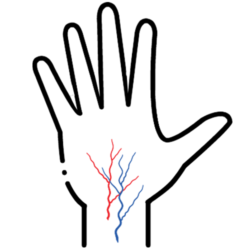 Hand Veins Treatment Oakland
